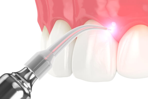 Laser Periodontal Treatment