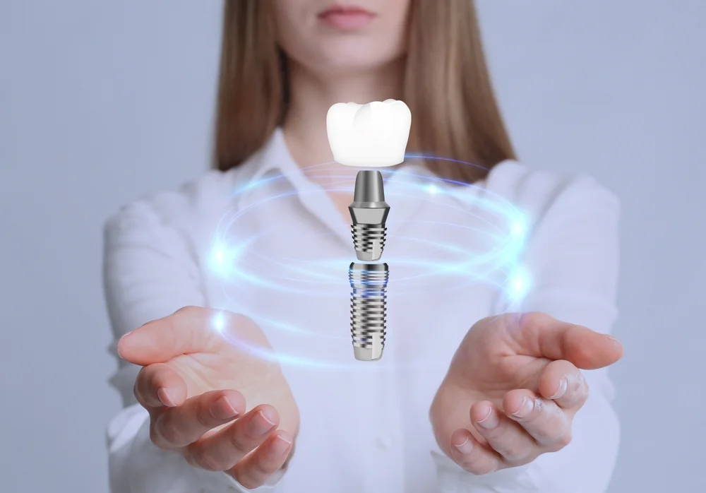 Exploring Dental Implant Alternatives in Laguna Niguel CA