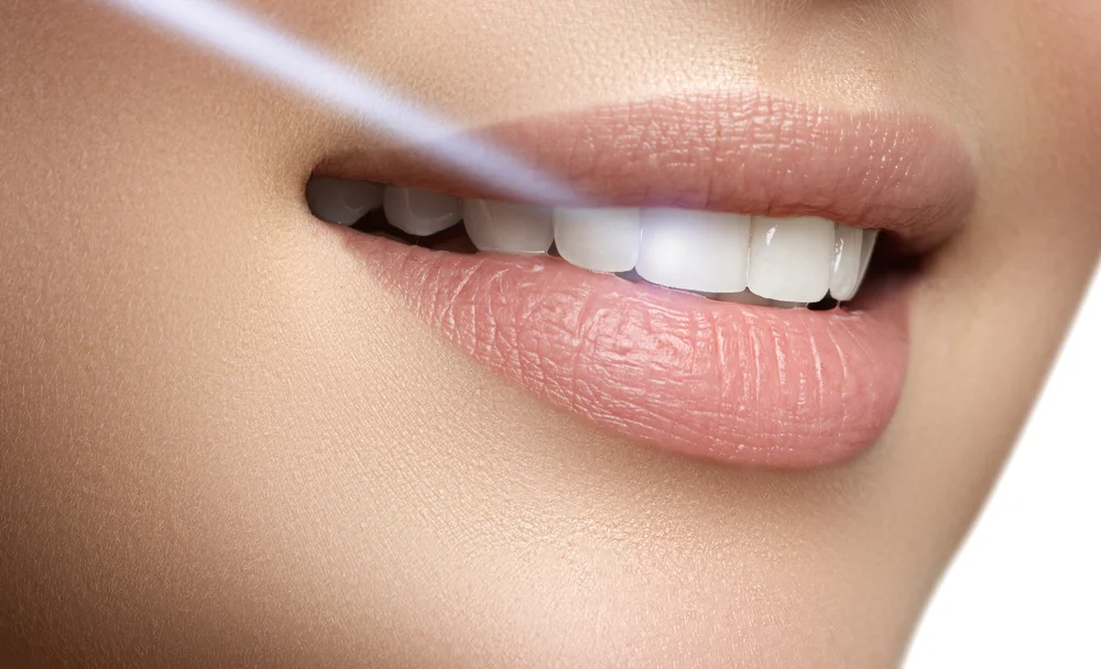 In-Office Teeth Whitening: Your Pathway to a Dazzling Smile