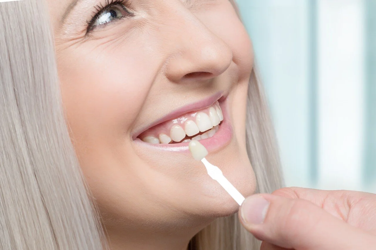 Dental Veneers: The Ultimate Solution for a Perfect Smile
