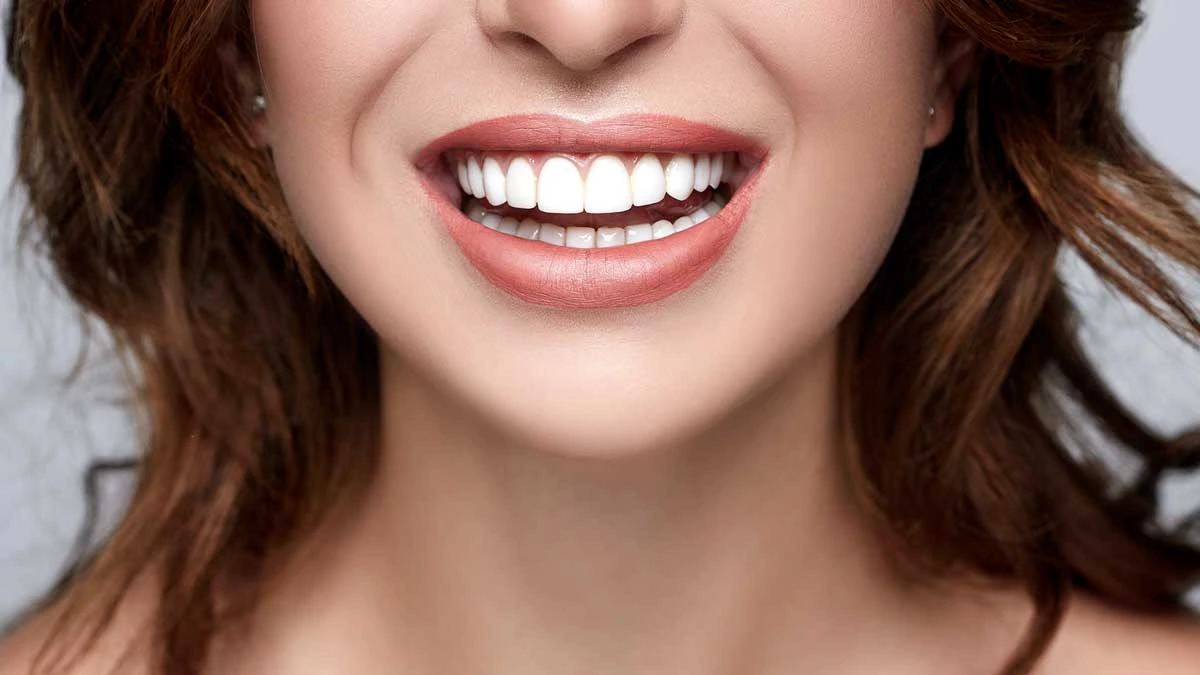 Choosing Between Composite and Porcelain Veneers