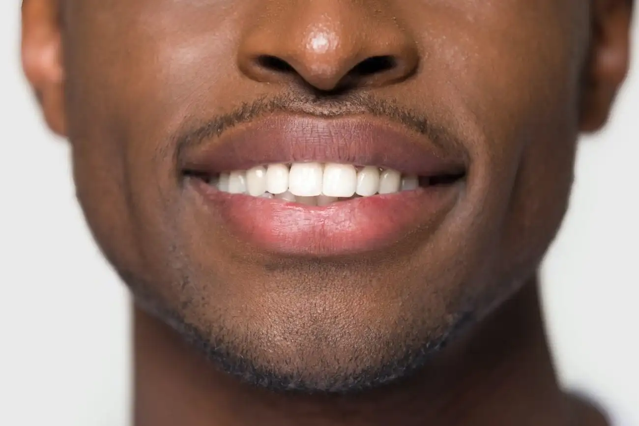 Dental Crown Sensitivity: Causes and Solutions