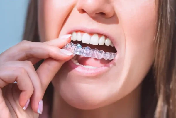 Eating Made Easy with Invisalign: Tips for Dining Without Stress